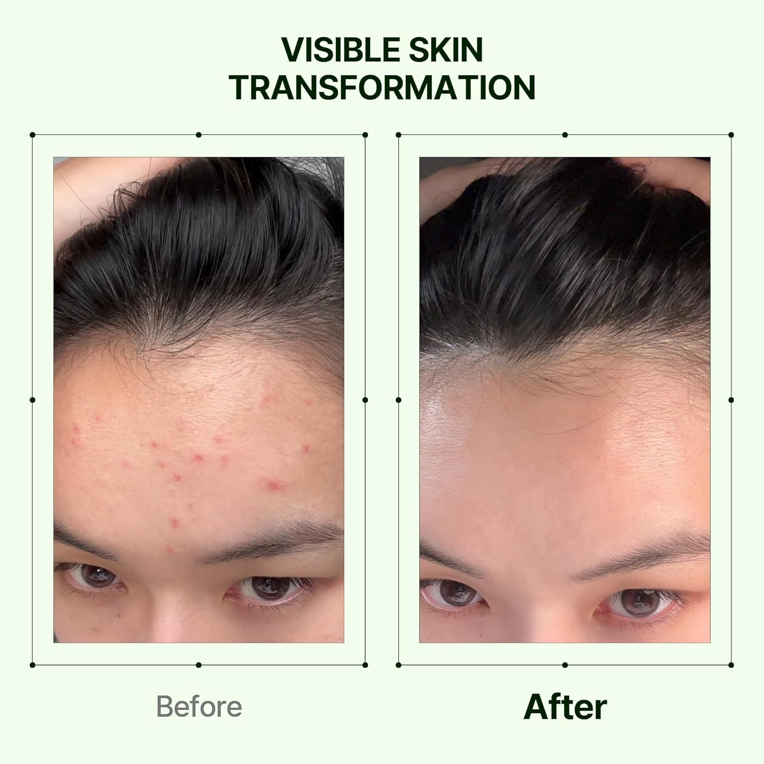 Orien Mugwort Soothe In Toner [160ml]	